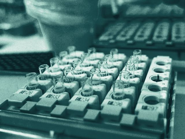 Specimen tubes in a rack